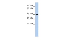ARL13B Antibody, Novus Biologicals 0.05mg; Unlabeled:Antibodies, Polyclonal